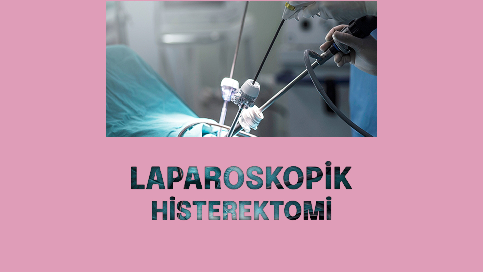 Histeroskopi
