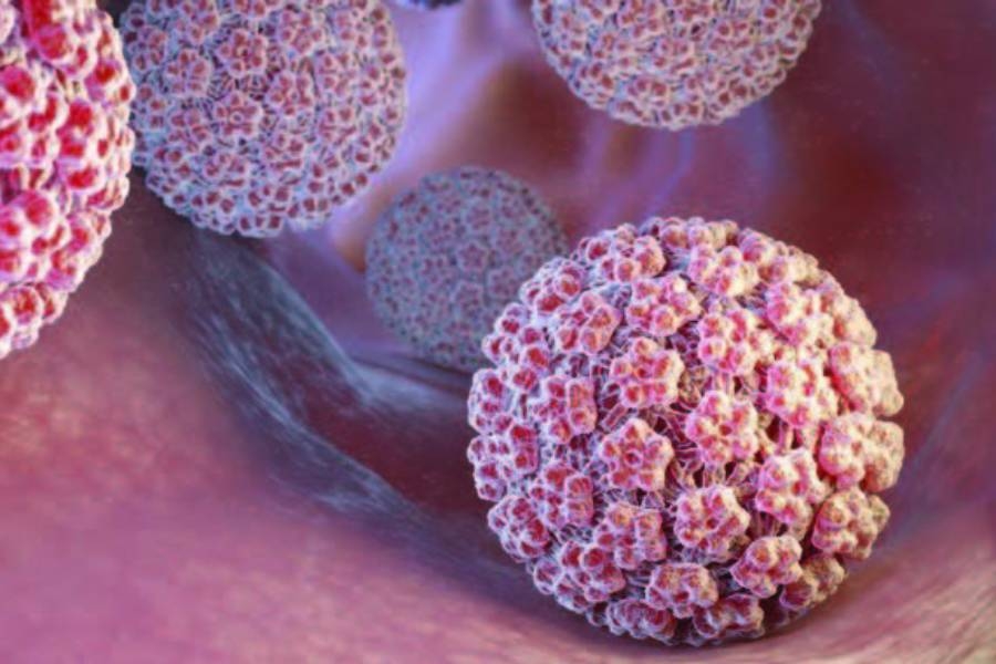 Hpv Tedavisi
