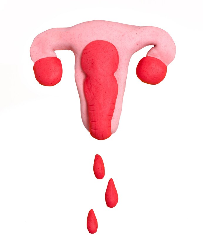 Vajina Daraltma Operasyonu