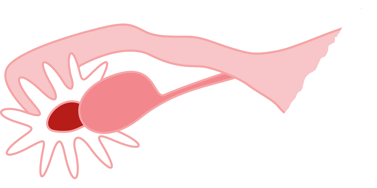 yumurtalık kisti tedavisi