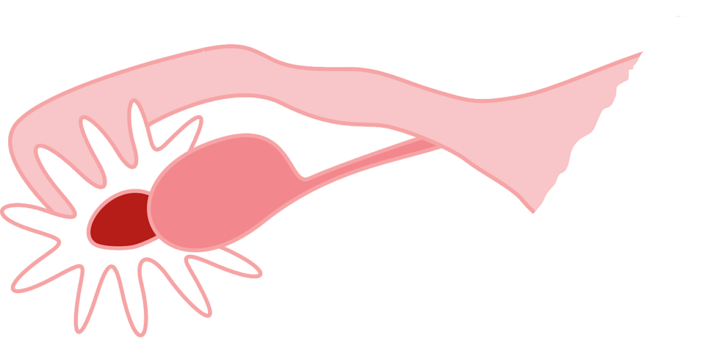 Sol Yumurtalık Kisti Belirtileri